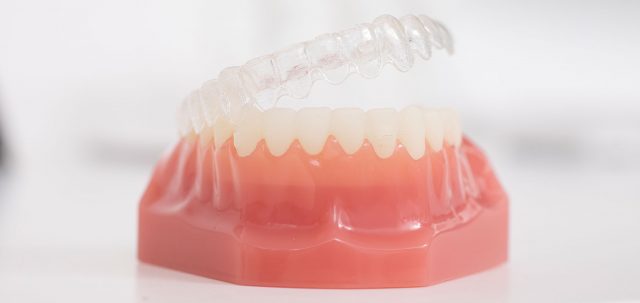 dorothee-jarleton-zahnarzt-praxis-koeln-Titelseite-Blog-Zahnheilkunde-und-Schwerpunkt-Zahnschienen